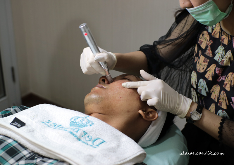 Pengalaman Melakukan Perawatan Wajah Untuk Pria di Klinik Dermaster Indonesia