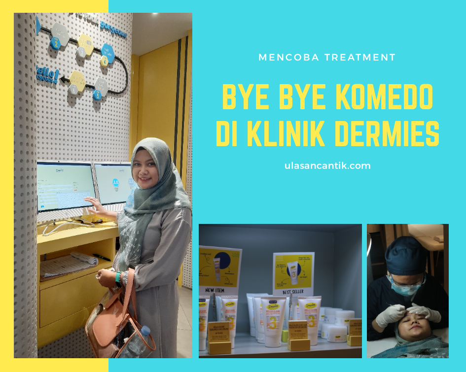Mencoba Treatment di Klinik Dermies Jakarta untuk Kulit Berjerawat