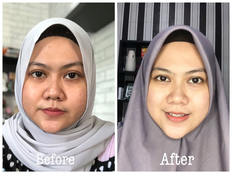 before after