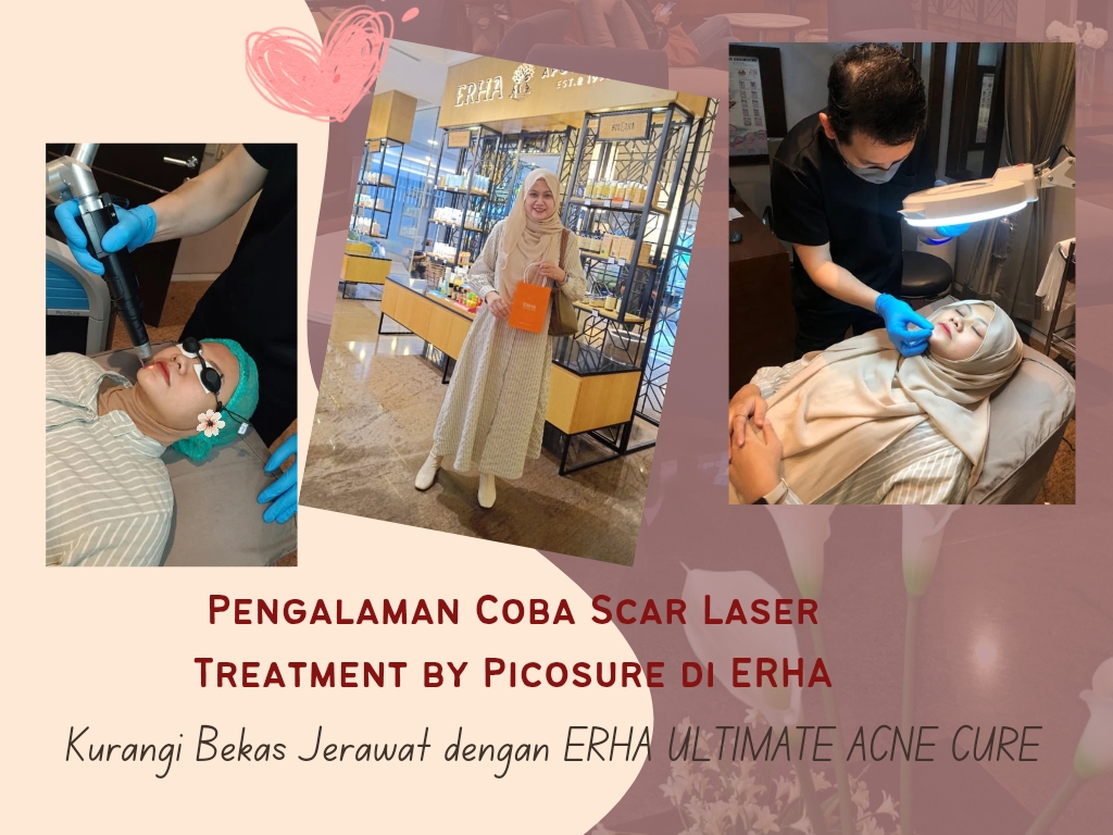 Pengalaman Scar Laser Treatment by Picosure di ERHA, Kurangi Bekas Jerawat dengan ERHA ULTIMATE ACNE CURE